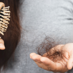 Natural Remedies To Stop Thinning Hair